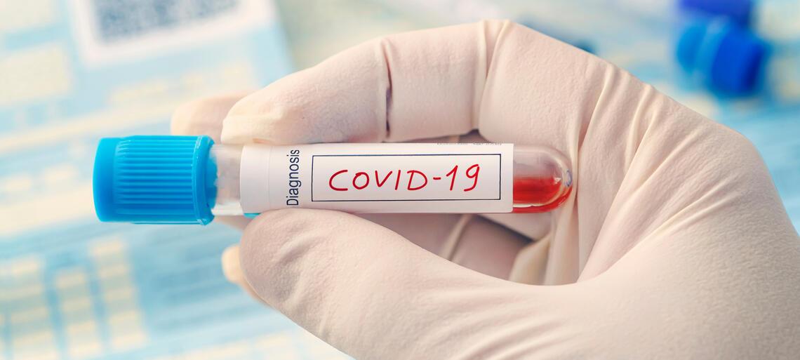 Serological Antibody Test And Nose And Throat Swab For Covid 19 Diagnosis At Auxologico Auxologico